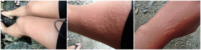 Skin Allergies... Yay!  --clck on image, if you want! haha!